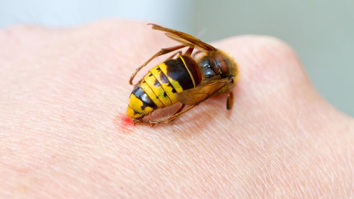 Wespenstich: Was tun bei Schwellung, Schmerz und Juckreiz nach einem Insekt...