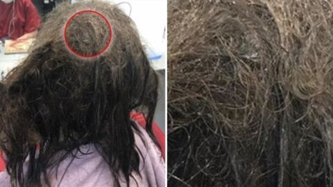 Diese junge Frau hat komplett verfilzte Haare! Nach 13 Stunden beim Friseur ist sie kaum wieder zu erkennen!