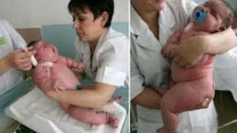 Dieses Baby ist das schwerste Baby der Welt und wiegt 18 Kilo!