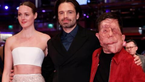 Entstellter Berlinale-Star Adam Pearson begeistert bei Premiere