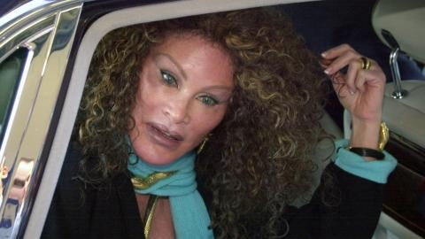 Tod von Jocelyne Wildenstein, der "Katzenfrau": Angebliche Ursache enthüllt