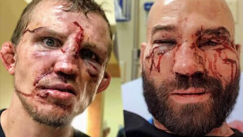 La bataille hallucinante entre Artem Lobov et Jason Knight au Bare Knuckle FC, en boxe à mains nues