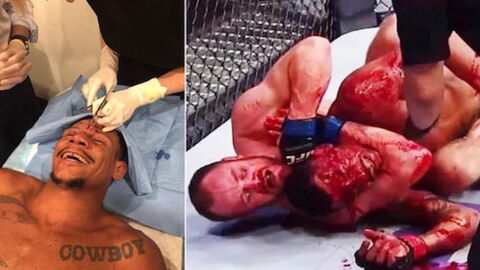 UFC 231 : Gunnar Nelson laisse une cicatrice monstrueuse sur Alex Oliveira