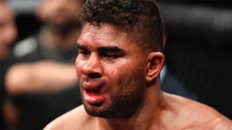 UFC : KO, Alistair Overeem souffre d'une horrible blessure à la lèvre (VIDEO)