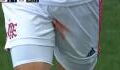 Football : Un Brésilien se coupe les testicules et quitte la pelouse avec le short en sang