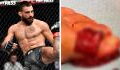 "Mon doigt de pied s'est séparé en 2", Benoit Saint-Denis révèle sa blessure après l'UFC Paris