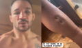 Michael Chandler affiche ses blessures inquiétantes après sa défaite face à Charles Oliveira