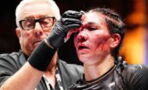 UFC 306 : une combattante défigurée après l'une des pires blessures de l'histoire