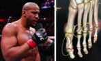 Ciryl Gane dévoile les détails de sa blessure contre Volkov, c'est plus grave que prévu