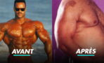 Ces légendes du bodybuilding qui ont vu leur corps se dégrader après leur carrière
