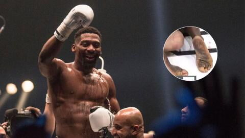 Pourquoi Cédric Doumbé a les pieds "sales" lorsqu'il combat en MMA ?