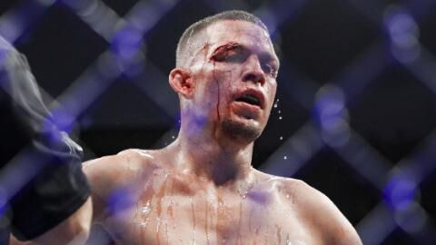 UFC : Nat Diaz annonce qu'il s'éloigne du MMA