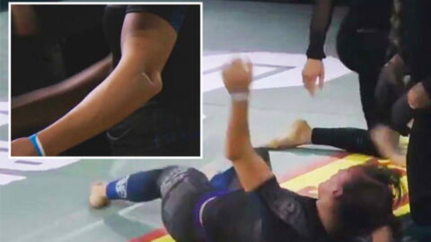 MMA : Une ancienne combattante de l'UFC brise le bras de son adversaire dans un combat de jiu-jitsu