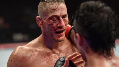 Niko Price défiguré après son combat contre Vicente Luque à l'UFC 249