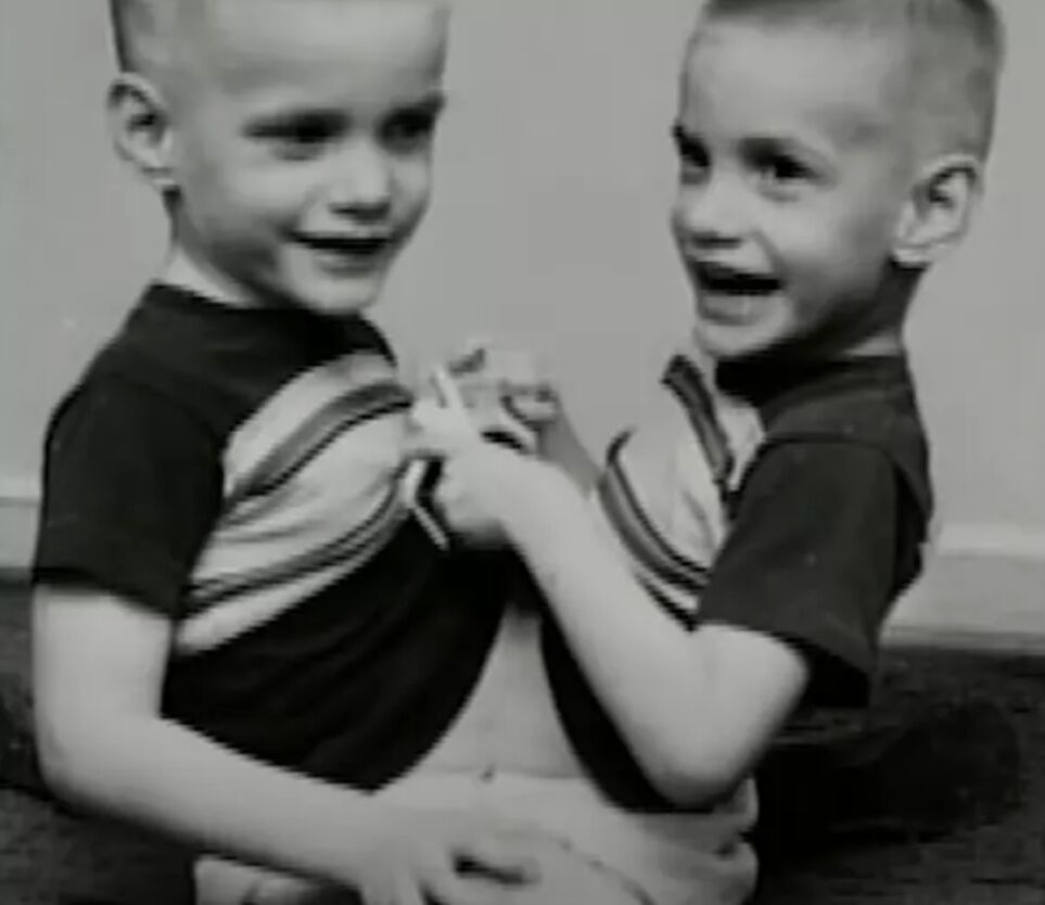 Ronnie And Donnie, The World's Oldest Conjoined Twins Have Died Aged 68