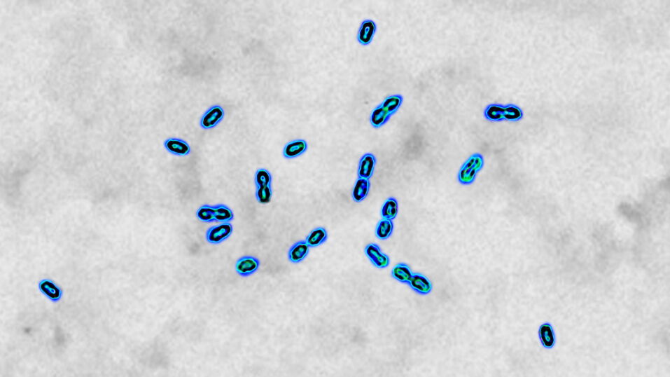 Strep A As the infection spreads in the UK, have other countries been