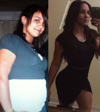 Natascha Encinosa avant/après