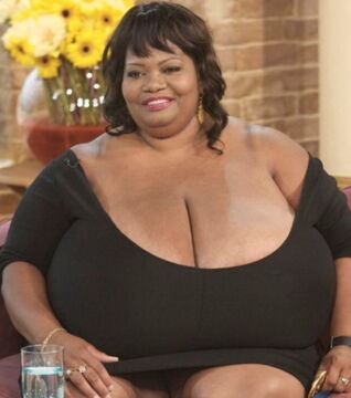 These are the world’s largest breasts, belonging to Norma Stitz. Her cup size? 102 ZZZ. The weight of just one breast? 55 lbs.
