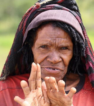 Beim Volk der Dani in Neuguinea lassen sich manche Frauen beim Tod naher Verwandter Fingerglieder amputieren. Die Verstümmelung dient dazu, ihre Toten zu ehren.