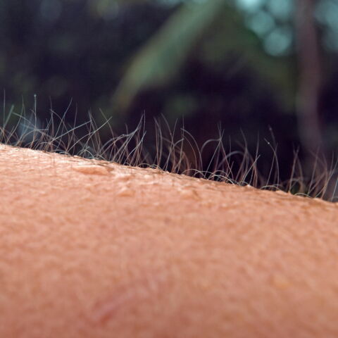 2. Der Haaraufrichtemuskel