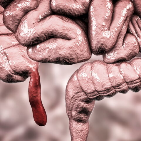 4. Der sogenannte Appendix