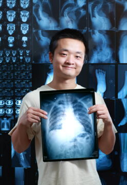 Der Unterschlüsselbeinmuskel oder Musculus subclavius hatte einen Zweck, als der Mensch noch nicht aufrecht ging