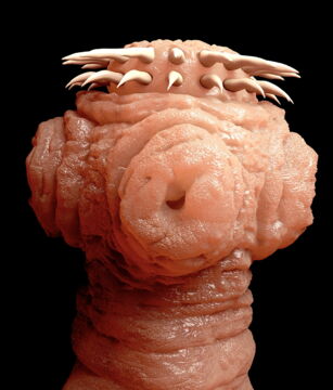 Nr. 10: Der Bandwurm ist ein unangenehmer Parasit, der die Infektion Zystizerkose verursacht.