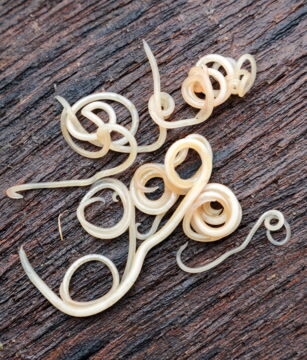 Nr. 8: Der Spulwurm nimmt pro Jahr 4.500 Menschenleben.