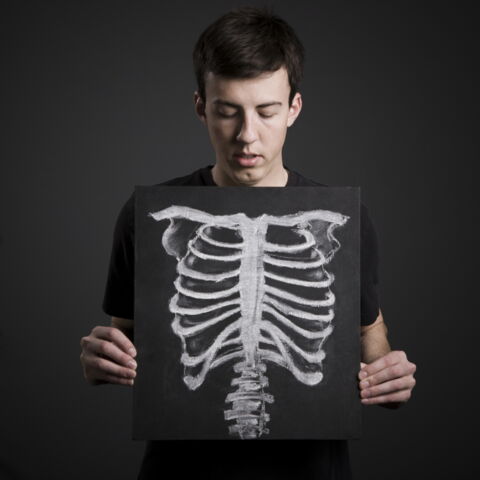 Nur 8 % der erwachsenen Menschen haben noch eine dreizehnte Rippe