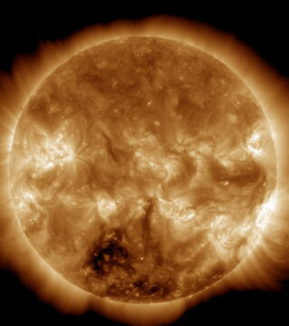 Porphyrie oder "Vampirkrankheit": Die Haut und die Augen betroffener Personen sind extrem lichtempfindlich