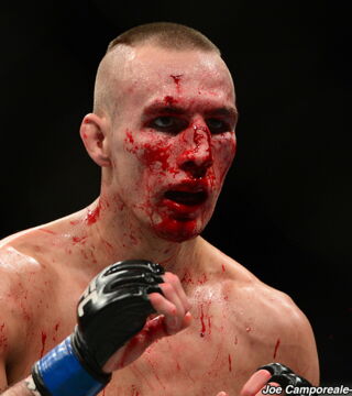 18. Rory MacDonald nahm an einem der epischsten Kämpfen der UFC-Geschichte teil. Als er gegen Robbie Lawler kämpfte, verließ der kanadische Psychopath blutverschmiert den Ring. Seine Nase war völlig zerstört.