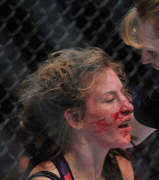 Im März 2006 musste Miesha Tate ihre Nase nach einem Kniestoß von Elisabeth Posener kurz abschreiben