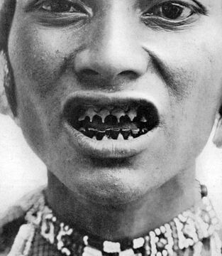 Im philippinischen Bagobo-Stamm haben die Menschen erschreckende Zähne. Die Beißer können eine hierarchische oder religiöse Bedeutung haben oder man will damit einfach nur Tiere abschrecken.