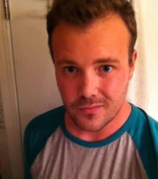 Verzicht auf Alkohol: Wie würde ich ohne Alkohol aussehen? Nacher: Nach 18 Monaten ohne Alkohol sind sie weg