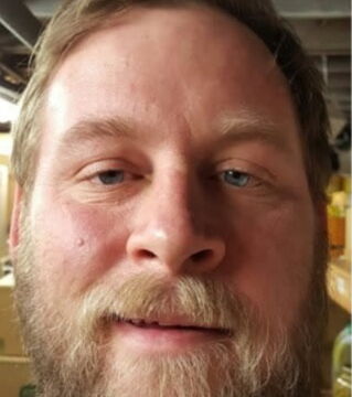 Verzicht auf Alkohol: Wie würde ich ohne Alkohol aussehen? Vorher: Der Alkohol steht diesem Herrn ins Gesicht geschrieben