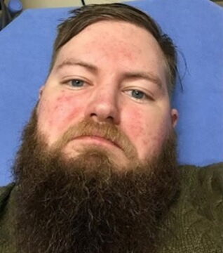 Verzicht auf Alkohol: Wie würde ich ohne Alkohol aussehen? Vorher: Dieser Mann blickt grimmig drein