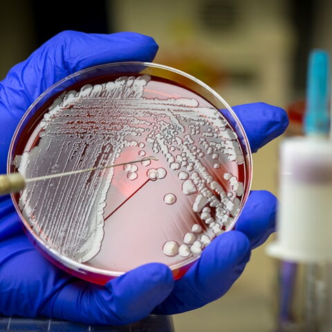 Darum wirst du häufiger von Mücken gestochen