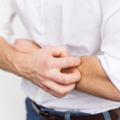 Darum wirst du häufiger von Mücken gestochen