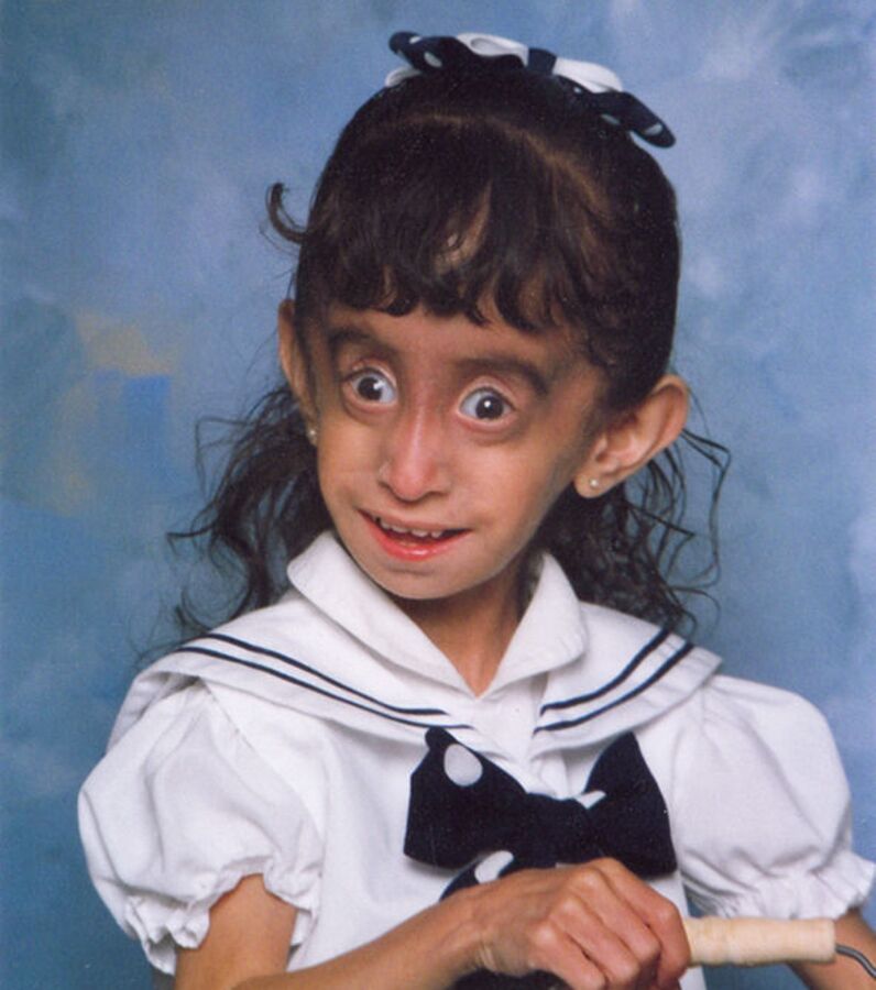 Sie nennen sie die hässlichste Frau der Welt Lizzie Velasquez