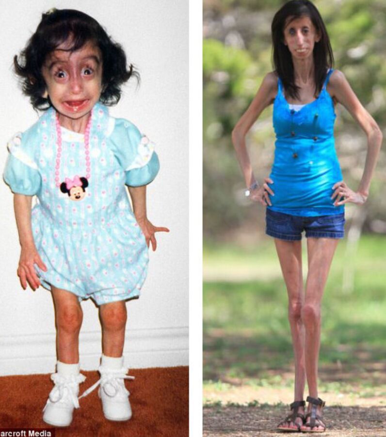 Sie Nennen Sie Die Hässlichste Frau Der Welt Lizzie Velasquez 3806