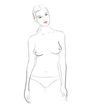 Die „Ost-West-Brust“: Brüste zeigen nach Ost und West