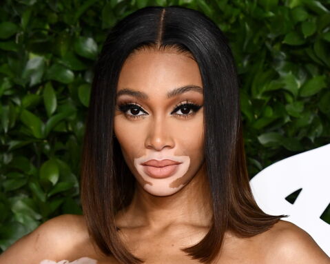 Winnie Harlow
