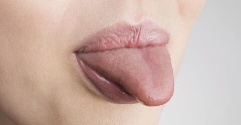 Gründe für einen kratzenden Hals: Pilzinfektionen im Mund- und Rachenraum