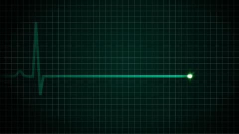 Das passiert, wenn wir sterben – Zeitpunkt 0