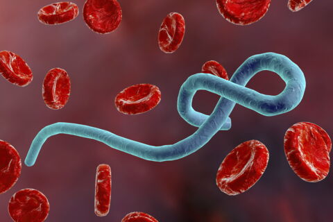 Ebola