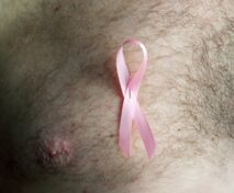 Comment lutter contre le cancer du sein chez l'homme