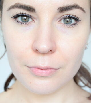 After: The result is a smooth and even-toned complexion with a softer appearance.