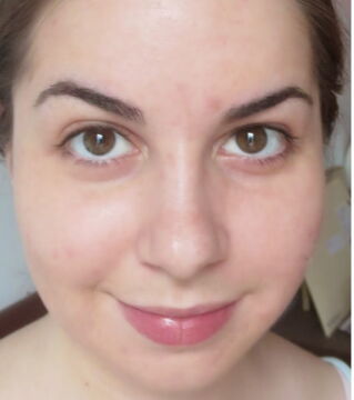 Before: Without using a BB cream, you are able to see your imperfections and blemishes!