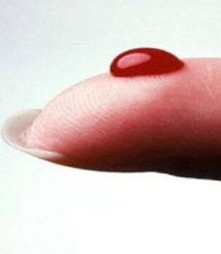 You have a group O blood type - Our dear mosquitoes love this blood type more than others.