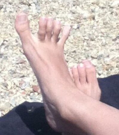 The worlds ugliest feet ranked